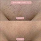 VelvetGlide™ — Enjoy Silky, Bump-Free Skin That Boosts Your Confidence Every Day