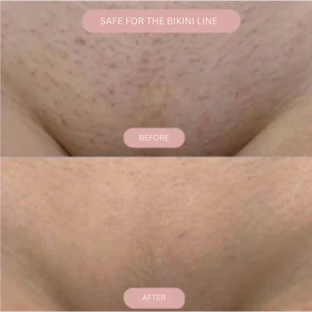 VelvetGlide™ — Enjoy Silky, Bump-Free Skin That Boosts Your Confidence Every Day