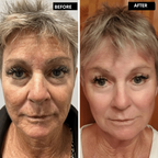 LumaFirme™ — Reveal Firmer, Radiant Skin That Turns Back Time in Just 14 Days