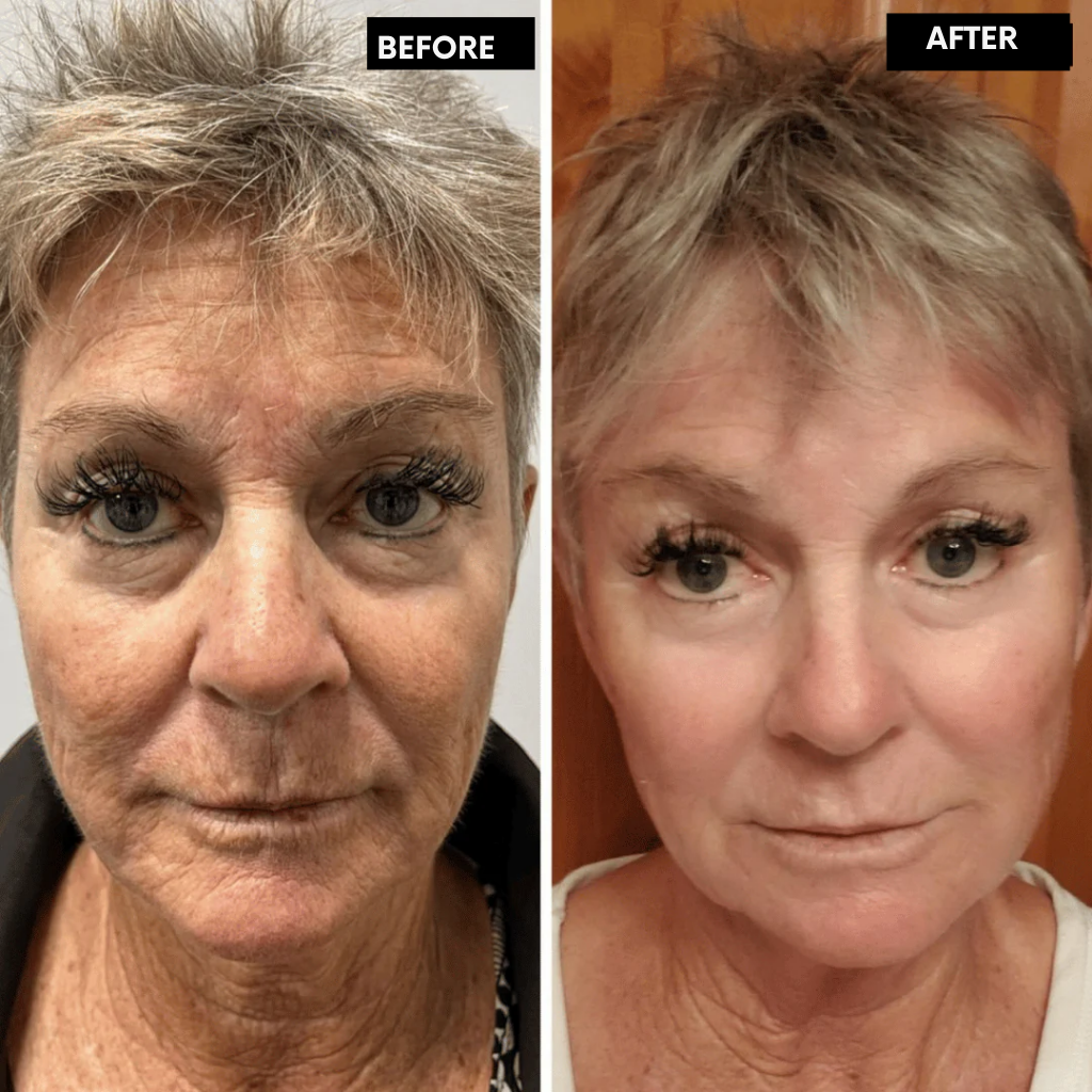 LumaFirme™ — Reveal Firmer, Radiant Skin That Turns Back Time in Just 14 Days