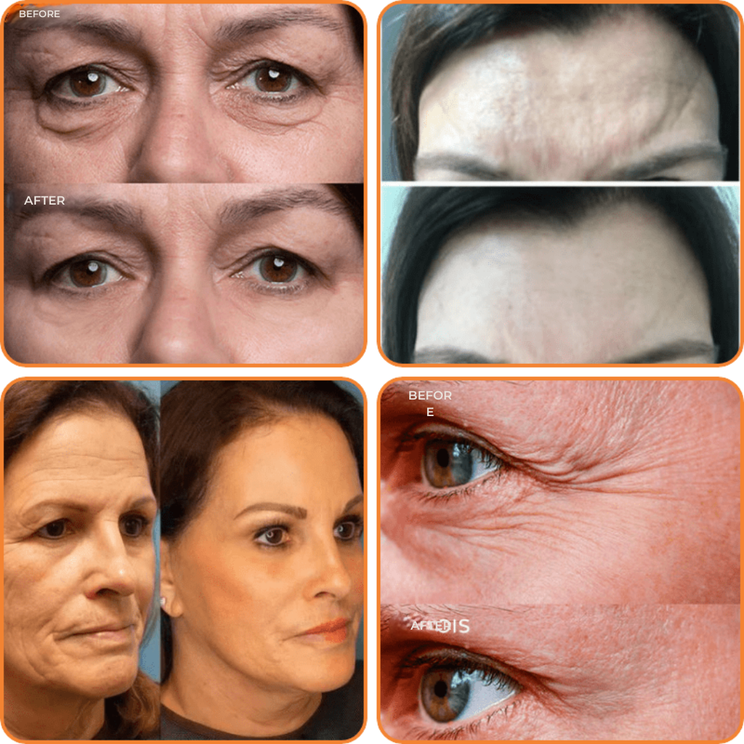 RevitaLift™ — Unlock Youthful Glow and Firm, Wrinkle-Free Skin in Days