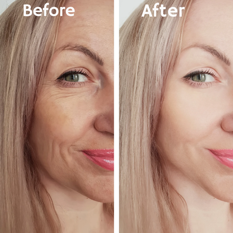 LumaRise™ — Instantly Lift and Glow with Unstoppable Confidence Every Day