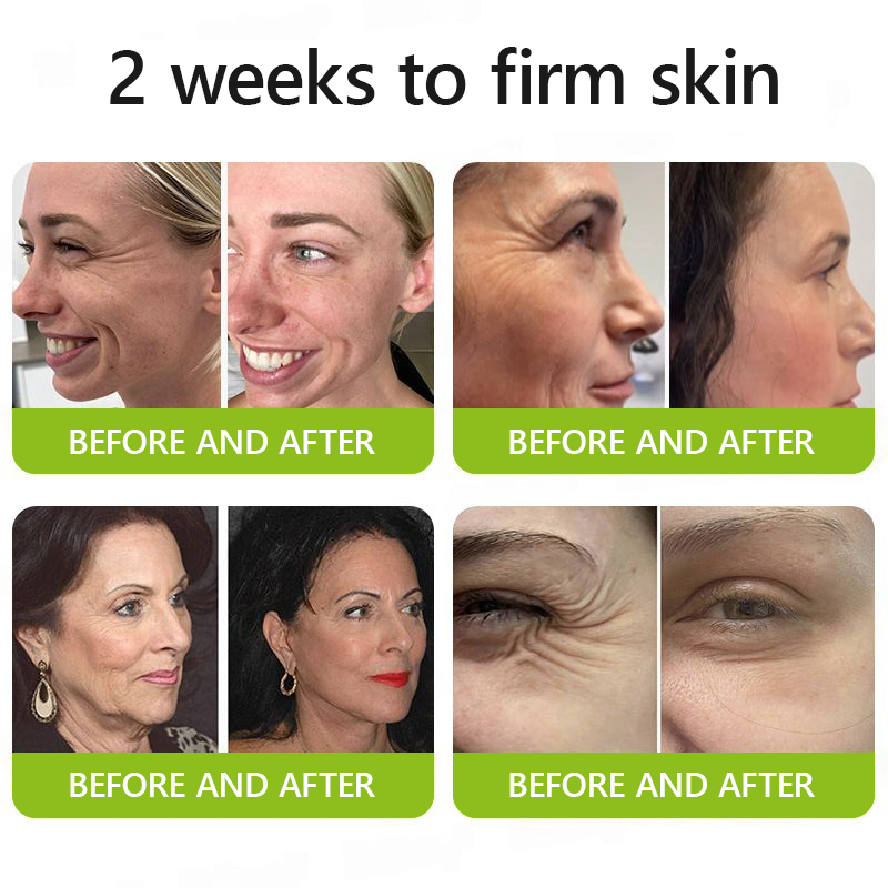 VelaBloom™ — Unleash Youthful Radiance with a Visible Lift in Just Days