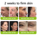 VelaBloom™ — Unleash Youthful Radiance with a Visible Lift in Just Days