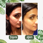 PureRadiance™ Detox Mask Stick — Instantly Clear Pores for Unstoppable Radiance and Confidence
