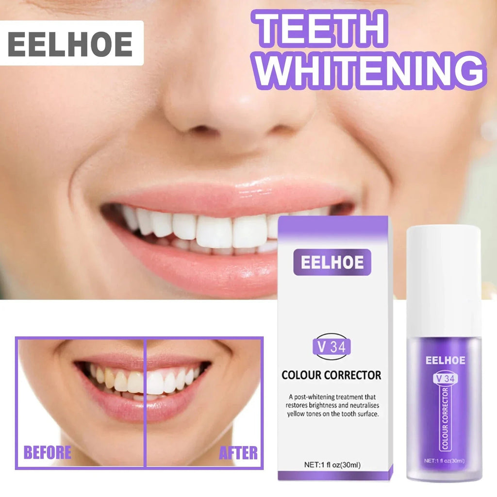 RadiantSmile™ — Instantly Ignite Confidence with Pain-Free, Dazzling Brightness