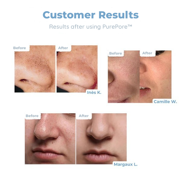 DermaVibe™ — Deep-Cleansing Power for Smooth, Radiant Skin You’ll Love to Show Off