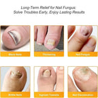 NailRevive™ — Unlock Clear, Strong Nails You’ll Proudly Flaunt Every Day
