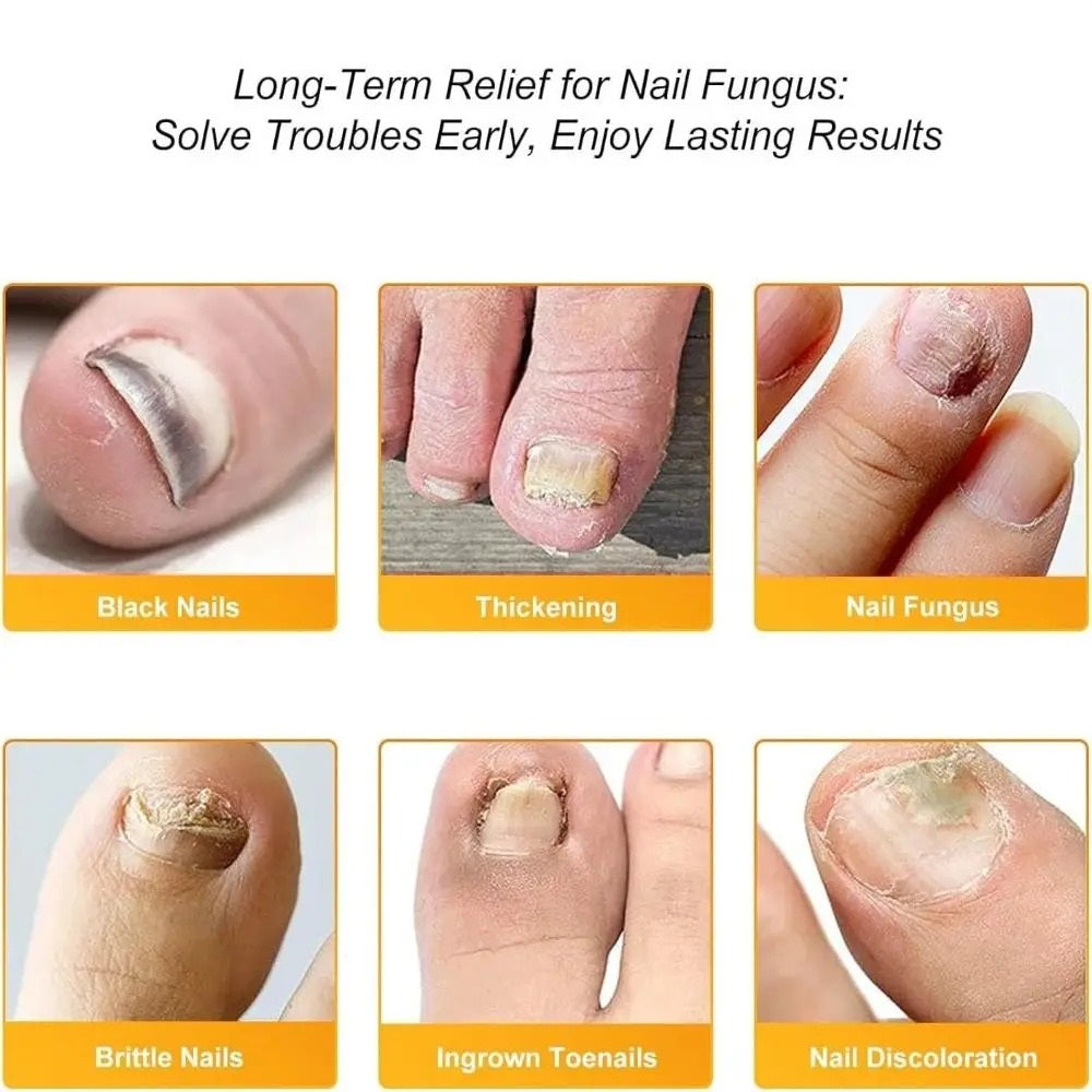 NailRevive™ — Unlock Clear, Strong Nails You’ll Proudly Flaunt Every Day