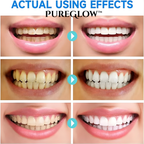 PureLustre™ — Transform Your Smile with Brighter Teeth, Stronger Enamel, and All-Day Freshness