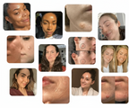 PureAura™ — Destroy Breakouts Fast and Shine with Unstoppable Confidence