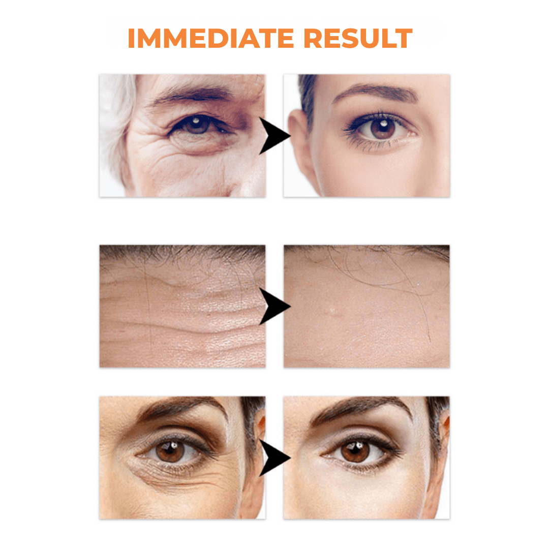 RevitaLift™ — Unlock Youthful Glow and Firm, Wrinkle-Free Skin in Days