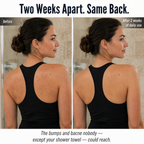 LuminaSheer™ — Clear Out Bacne, Back Bumps & Dead Skin Beyond a Loofah’s Grasp