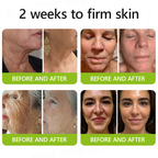 VelaBloom™ — Unleash Youthful Radiance with a Visible Lift in Just Days