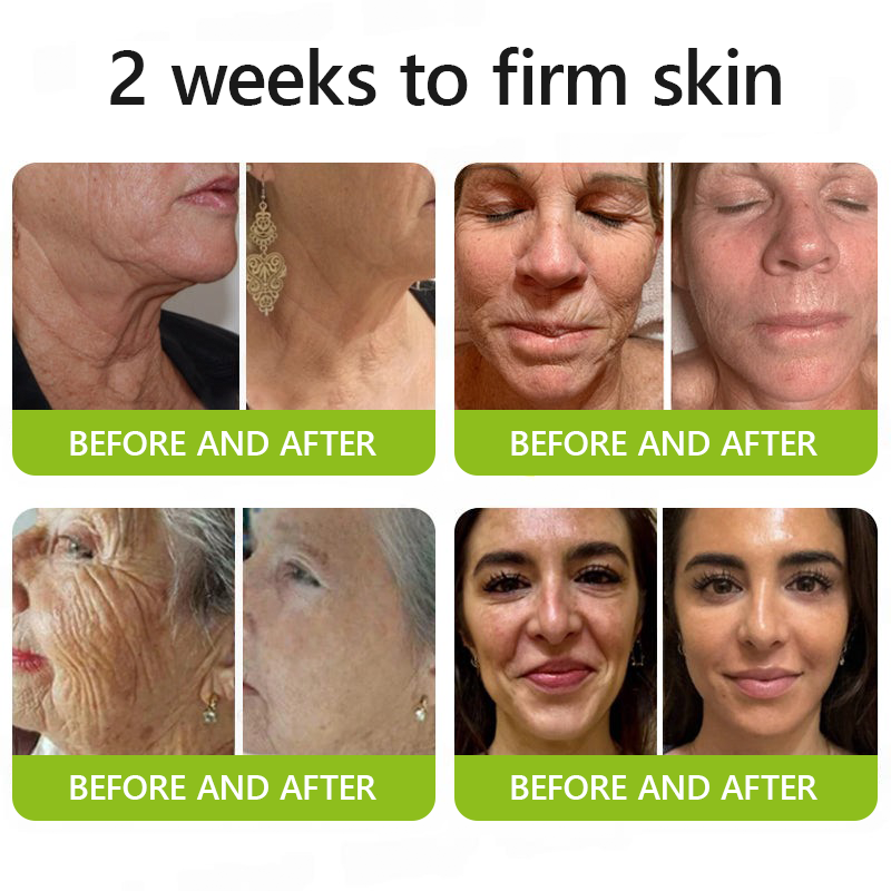 VelaBloom™ — Unleash Youthful Radiance with a Visible Lift in Just Days