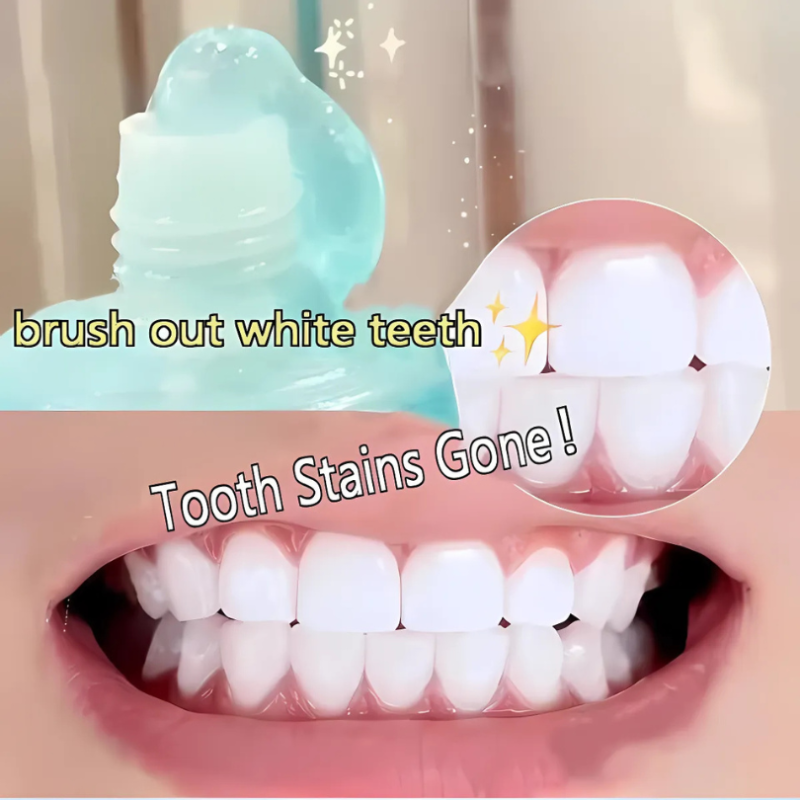 LumaShine™ — Unleash a Radiant, Pain-Free Smile That Commands Attention