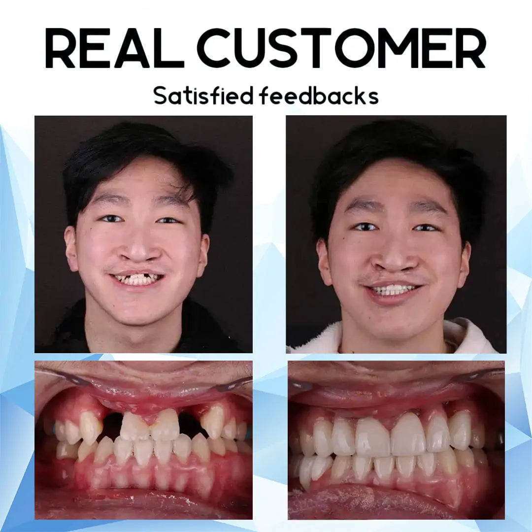 DentiSure™ Silicone Fit — Unlock Radiant Confidence with a Perfectly Secure Smile