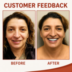 Denture Adjustment Kit | Custom Moldable Medical-Grade Silicone | Full & Partial Dentures