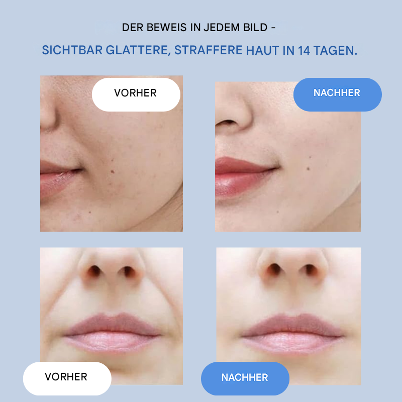 Face Lifting Strips | Instant Firming & Smoothing | Ultra-Thin Gel for Eyes & Cheeks