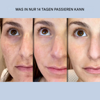 Face Lifting Strips | Instant Firming & Smoothing | Ultra-Thin Gel for Eyes & Cheeks