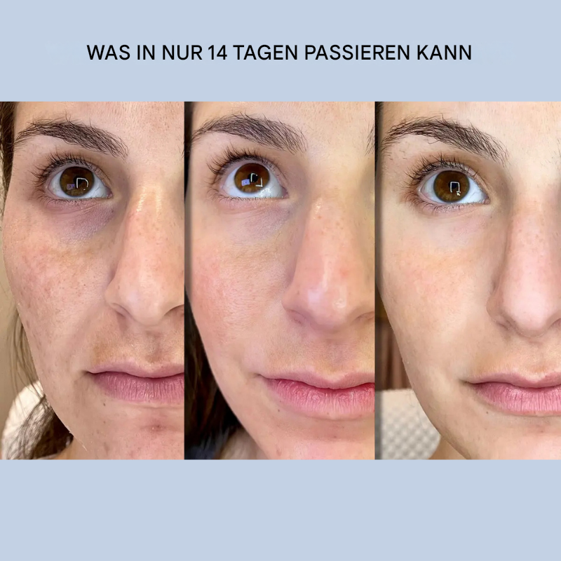 Face Lifting Strips | Instant Firming & Smoothing | Ultra-Thin Gel for Eyes & Cheeks