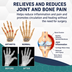 Joint Pain Relief Cream | Bee Venom Warming Formula | 30 g | Soothing Relief