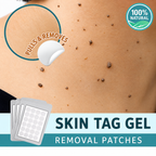 Skin Tag Removal Patches | Pain-Free Natural Formula | Multi-Patch Pack | Discreet Wear