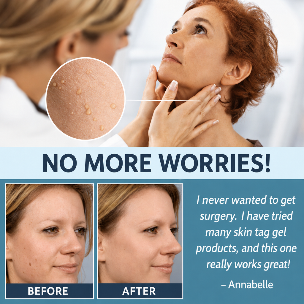 Skin Tag Removal Patches | Pain-Free Natural Formula | Multi-Patch Pack | Discreet Wear
