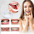 Snap-On Denture | Adjustable Fit | Natural-Looking Smile