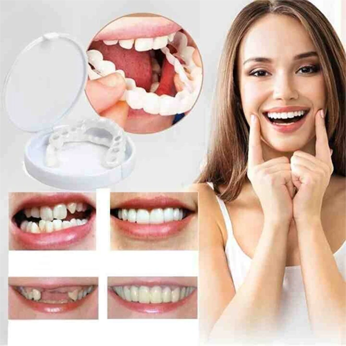 Snap-On Denture | Adjustable Fit | Natural-Looking Smile