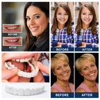 Snap-On Denture | Adjustable Fit | Natural-Looking Smile