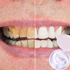 Snap-On Veneers | Flexible Fit Without Adhesive | Upper & Lower Set | Comfortable Fit