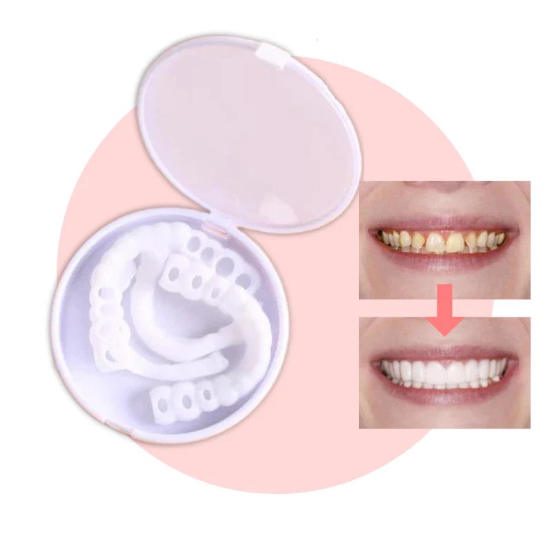 Snap-On Veneers | Flexible Fit Without Adhesive | Upper & Lower Set | Comfortable Fit