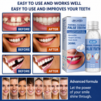 Tooth Repair Kit | Instant Tooth Filler | Natural Tooth-Colored Resin | Temporary Cosmetic Repair