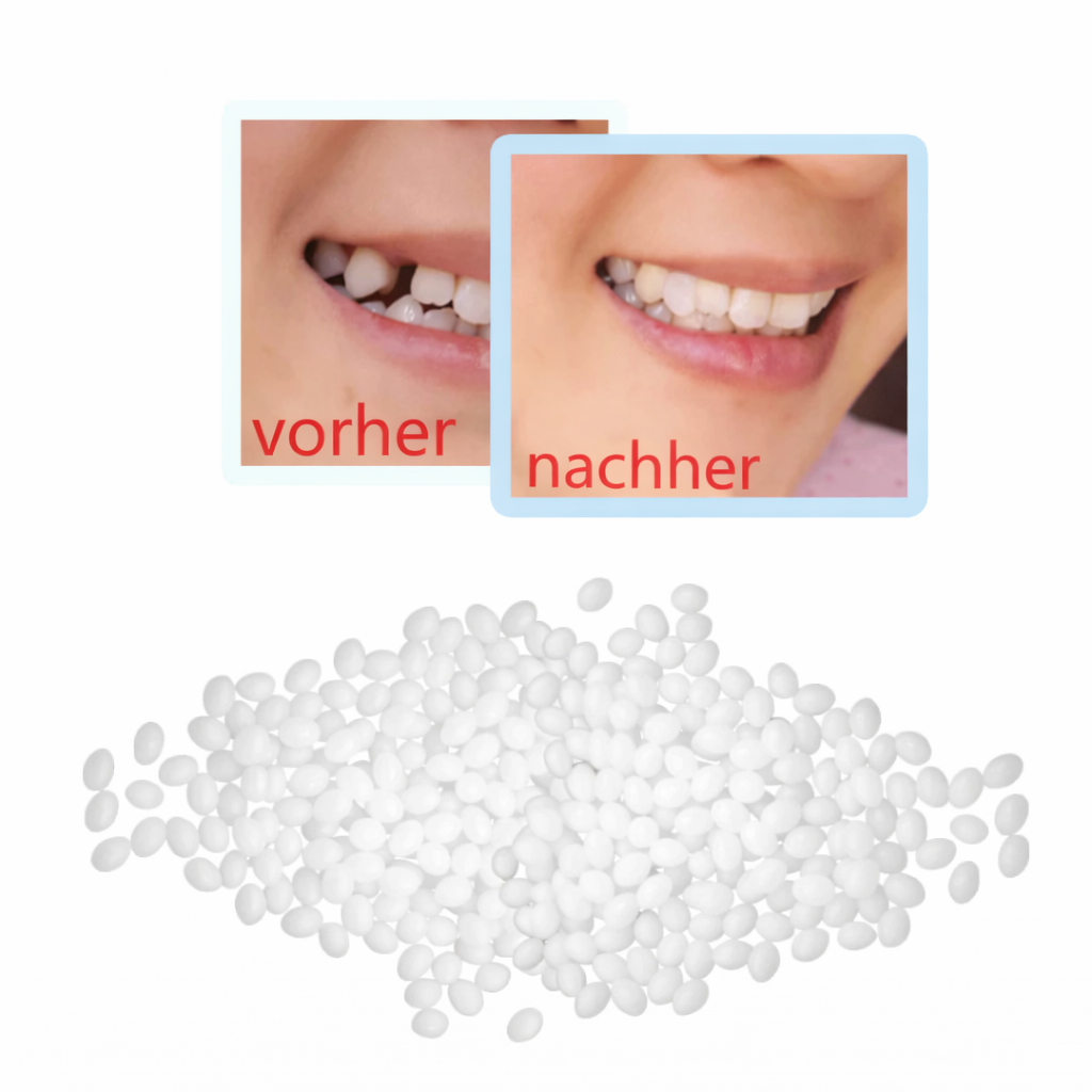 Tooth Repair Kit | Moldable Granules Filler | White & Reusable | Smile Restoration