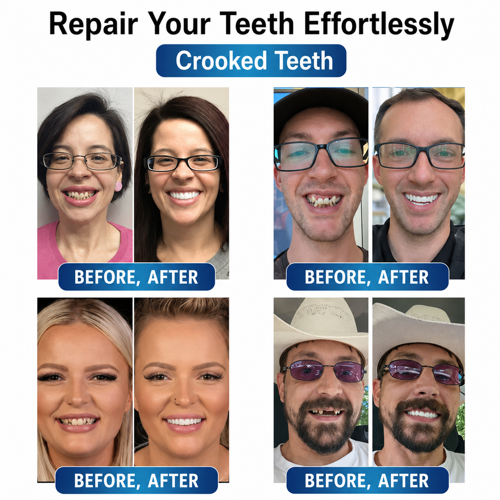 Tooth Repair Kit for Adults | Moldable Denture Gel & LED Curing | Natural-Looking Repair