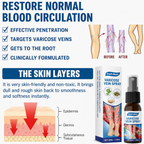 Varicose Vein Care Spray | Targeted Spray Application | Fast-Absorbing 30ml