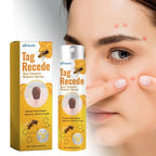 Wart Removal Spray | Targeted Bee Venom Formula | Scar-Free Healing