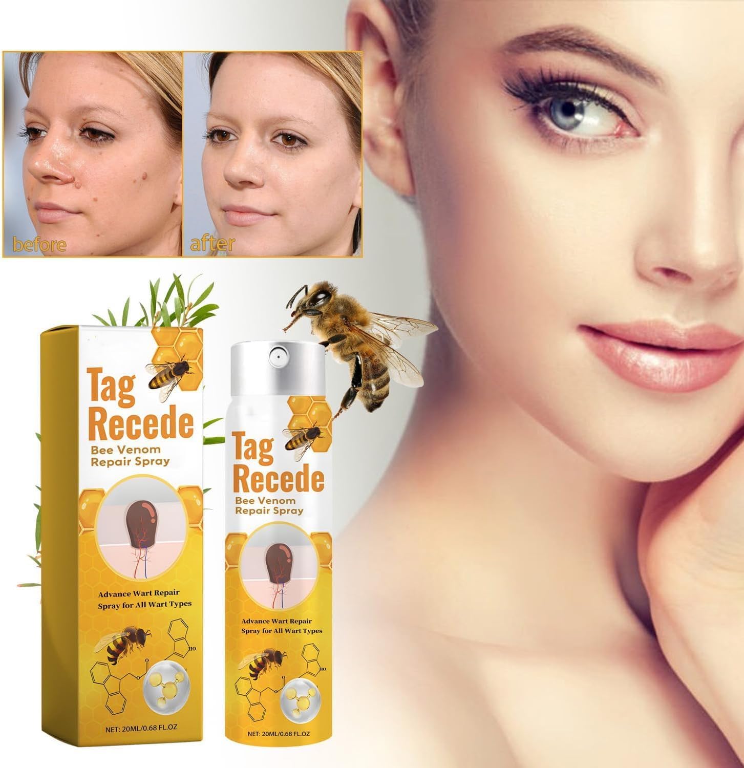 Wart Removal Spray | Targeted Bee Venom Formula | Scar-Free Healing