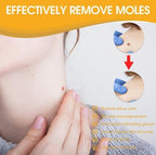 Wart Removal Spray | Targeted Bee Venom Formula | Scar-Free Healing