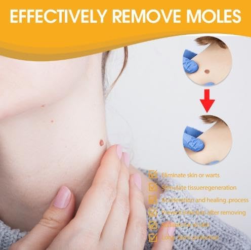Wart Removal Spray | Targeted Bee Venom Formula | Scar-Free Healing