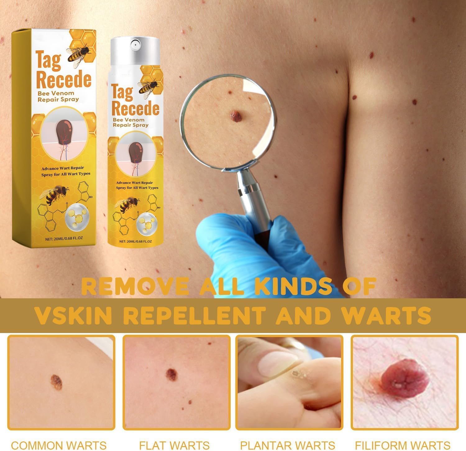 Wart Removal Spray | Targeted Bee Venom Formula | Scar-Free Healing