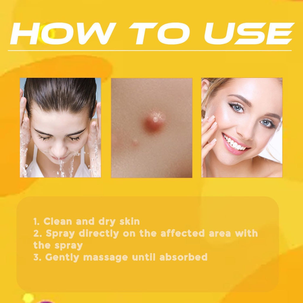 Wart Removal Spray | Targeted Bee Venom Formula | Scar-Free Healing