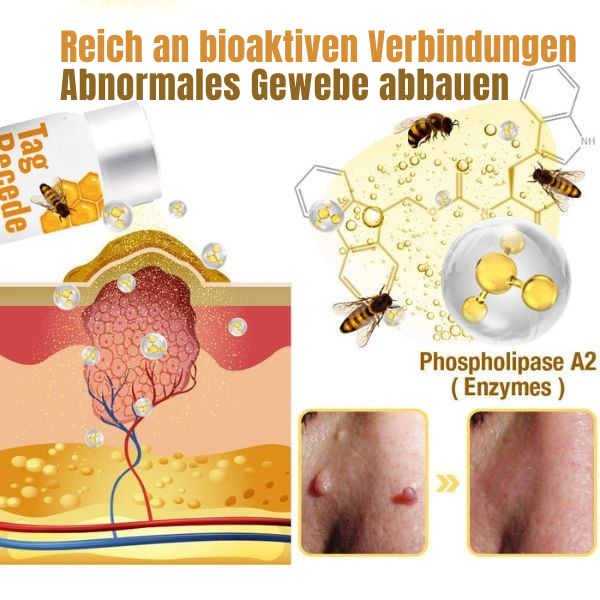 Wart Remover Spray | Bee Venom-Inspired Gentle Formula | 20ml | Pain-Free Application