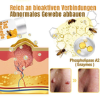 Wart Remover Spray | Bee Venom-Inspired Gentle Formula | 20ml | Pain-Free Application