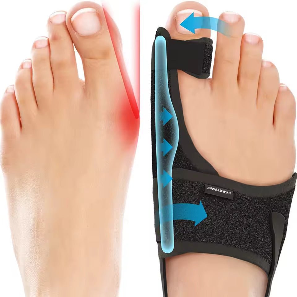 Bunion Night Splint | Ergonomic & Adjustable | Comfort Padding & Velcro | Nighttime Support
