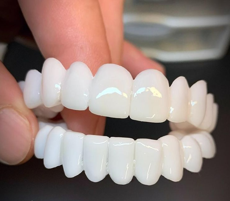 Dental Veneers | Natural-Looking Flexible Fit | Durable Resin & Reusable