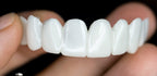 Dental Veneers | Natural-Looking Flexible Fit | Durable Resin & Reusable
