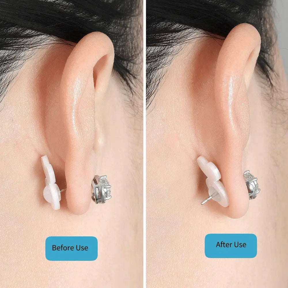 Earring Stabilizer | Food-Grade Silicone Ear Lifter | Hypoallergenic Support for Heavy Earrings