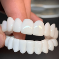 Removable Dental Veneers | Natural-Looking White Veneers | Adjustable & Reusable | Comfortable Fit
